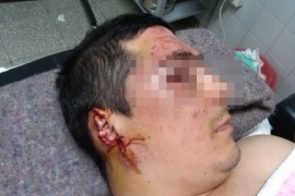 Fue golpeado por un vecino y luego atacado por su perro
