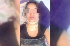 Atropelló a dos mujeres, huyó del lugar y luego fijó domicilio