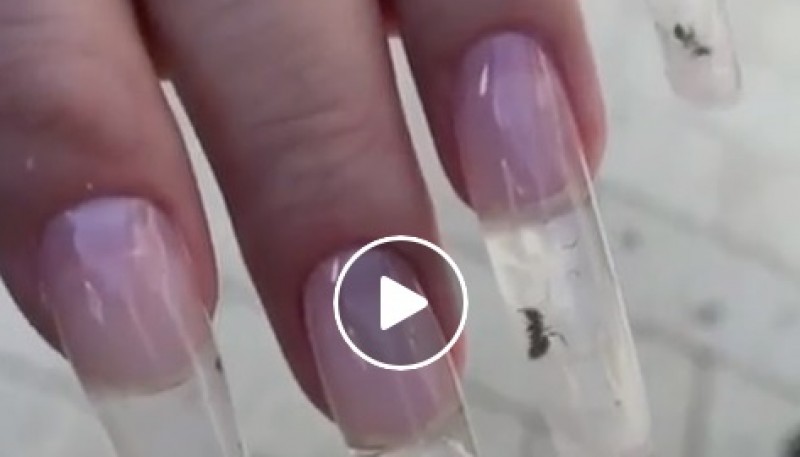 Hormigas en las uñas. 