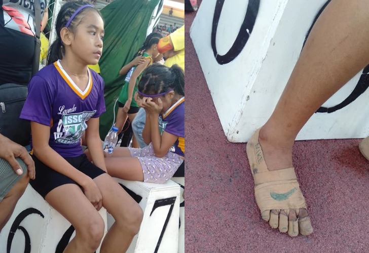 La imagen de esta nena y sus pies se viralizaron rápidamente. Crédito: Facebook Predirick Valenzuela