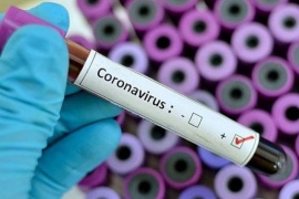 Confirmaron la séptima víctima de coronavirus en Argentina