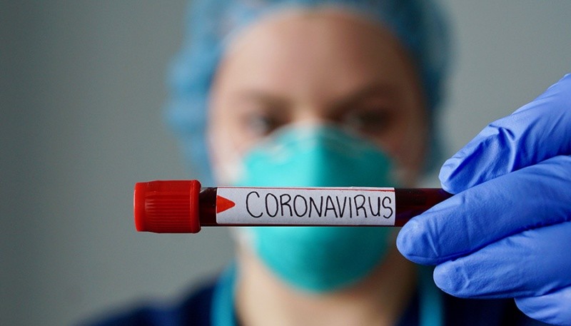 Muestra de sangre por coronavirus. 