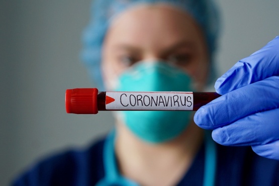 Muestra de sangre por coronavirus. 
