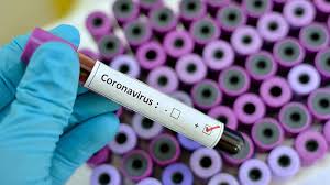 Coronavirus Positivo.