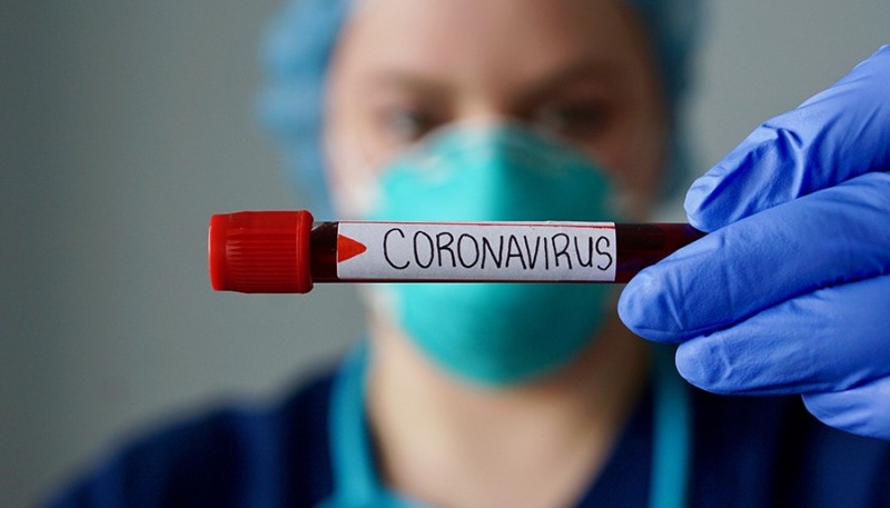 Coronavirus positivo.