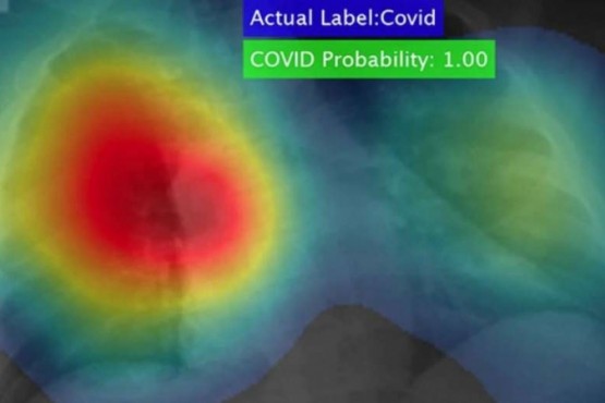 Se desarrolló un software que puede detectar el coronavirus en segundos