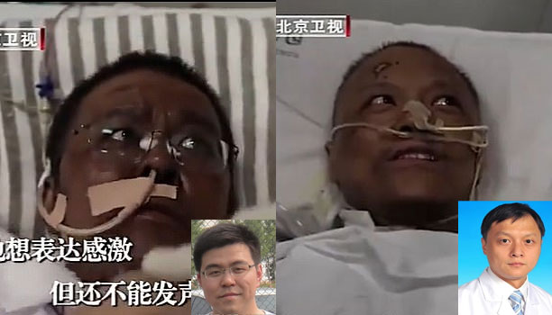 Médicos chinos en estado crítico se despertaron con su piel oscurecida