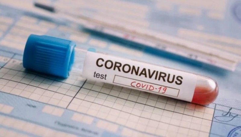 Coronavirus: Ya son 192 las muertes y 3892 los infectados en le país