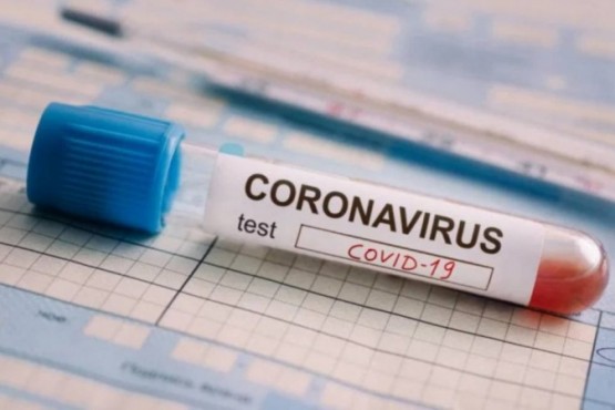 Coronavirus: Ya son 192 las muertes y 3892 los infectados en le país