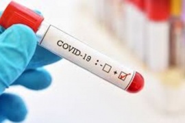 Coronavirus: Ya son 237 las víctimas fatales y 4681 los casos positivos