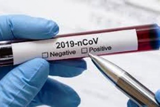 Hace 480 días que un paciente da positivo de coronavirus
