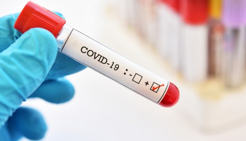 Coronavirus: Se registraron 258 nuevo casos y cinco muertes 