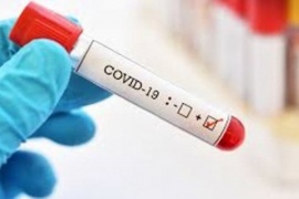 Se descartaron 313 casos de Coronavirus