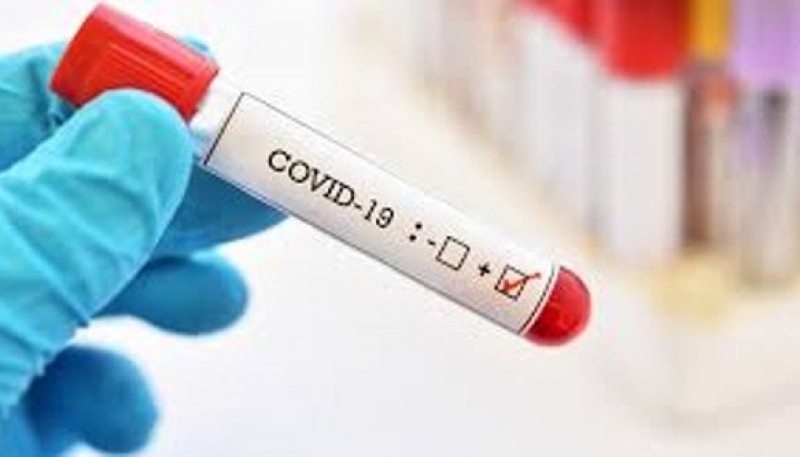 Se descartaron 313 casos de Coronavirus