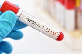 Coronavirus: Se registraron siete nuevas muertes y 263 casos positivos