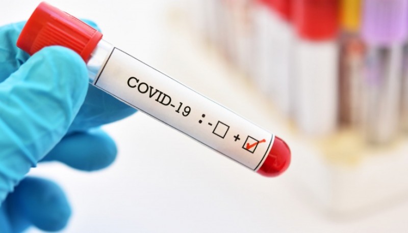 Coronavirus: Se registraron siete nuevas muertes y 263 casos positivos 