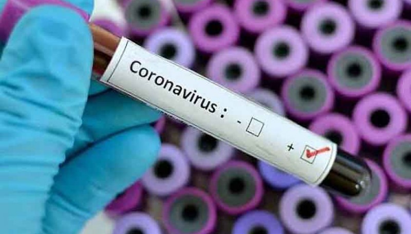 Coronavirus: Confirmaron 704 nuevos casos positivos 