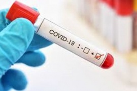 Coronavirus: Se confirmaron 769 nuevos casos de COVID-19