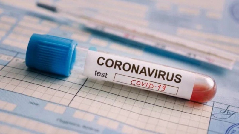 Argentina desarrolla nuevo kit para detectar el coronavirus