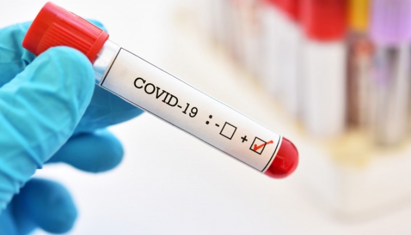 Coronavirus: 637 nuevos casos y nueve muertes por COVID-19