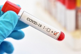 Coronavirus: Se confirmaron 794 casos nuevos y ocho muertes