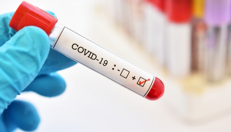 Coronavirus: Se confirmaron 794 casos nuevos y ocho muertes 