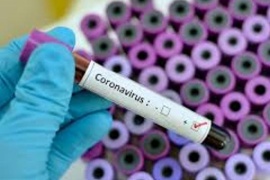 Coronavirus: 1958 casos nuevos y 35 muertes