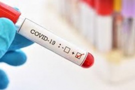 Coronavirus: 2060 casos nuevos de COVID-19