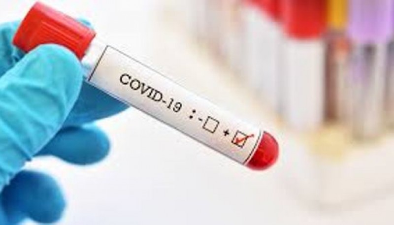 Coronavirus: 2060 casos nuevos de COVID-19