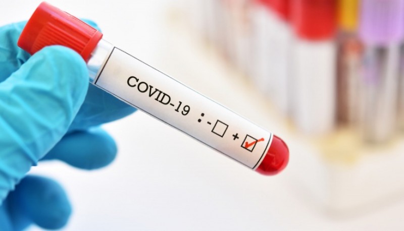 Coronavirus: 18 nuevos fallecidos 