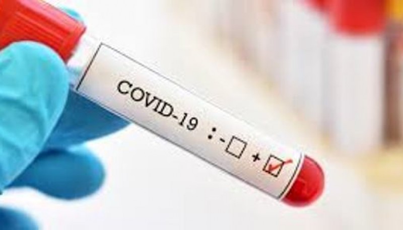 Coronavirus: Casi 78 mil contagiados en el país 