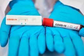 Coronavirus en Argentina: 1.523 fallecidos y 77.815 personas contagiadas