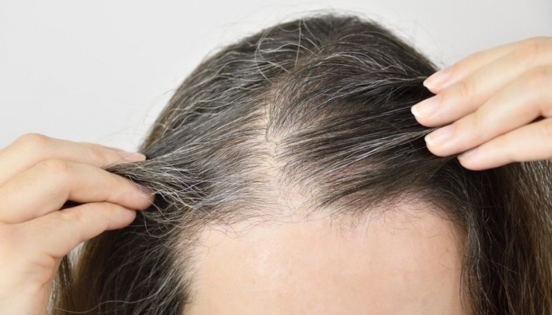 Seis causas por las que pueden aparecer canas en el pelo