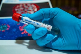 Coronavirus: Hay 268 casos confirmados y 220 recuperados