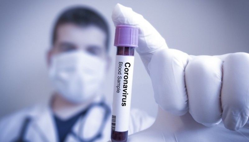 Coronavirus: Confirmaron 7.112 casos en las últimas 24 horas