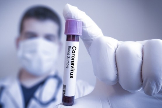 Coronavirus: 162 nuevas muertes y 6.843 contagios en las últimas 24 horas