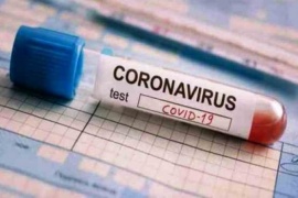 Cuáles son los síntomas preponderantes en casos positivos de Coronavirus en Santa Cruz