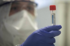 Rusia se prepara para registrar la primera vacuna contra el coronavirus