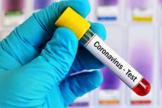 Se detectó un nuevo caso positivo de Coronavirus