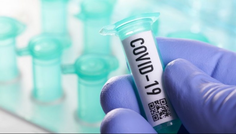 Coronavirus: confirmaron 11.807 casos en las últimas 24 horas
