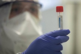 Santa Cruz sumó 40 positivos de Coronavirus y son más de 900 los casos activos