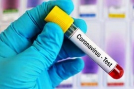El Coronavirus no afloja y Río Gallegos registró 74 nuevos positivos