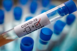 Se registraron 238 casos positivos de coronavirus en Chubut