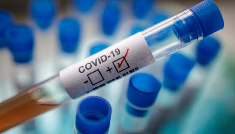 Coronavirus: Se registraron dos nuevos fallecidos 