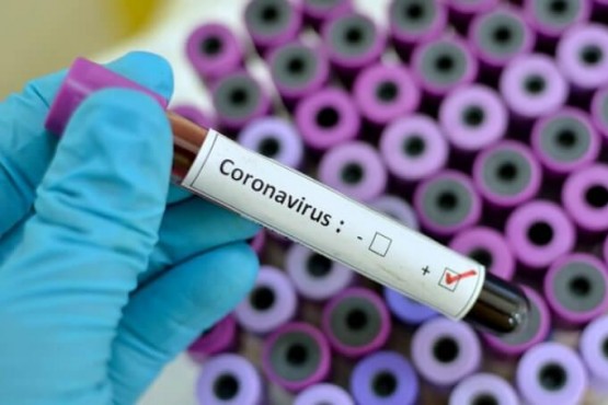 En el último reporte El Calafate registra 50 casos activos de Coronavirus