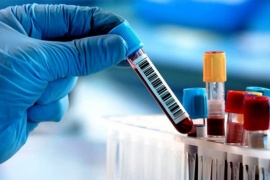 Avanza el Coronavirus en Santa Cruz: 139 casos nuevos en 6 localidades