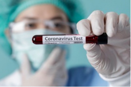 Coronavirus en Santa Cruz: 136 nuevos positivos y ya son 1375 los casos activos