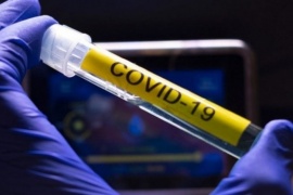 No paran los contagios en Santa Cruz: 157 nuevos positivos de COVID