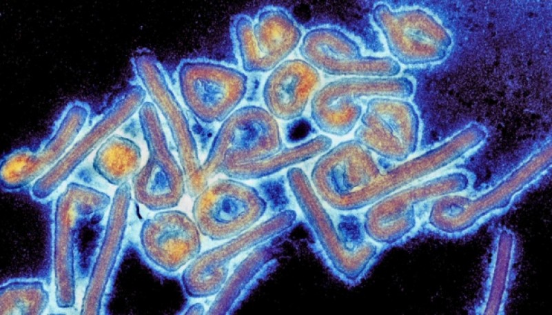 Chapare: el virus letal con síntomas compatibles al coronavirus que despierta alarmas