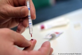 HIV: Testeos en tiempo de pandemia